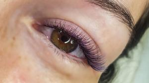 Фотография Blumberg Lash 4