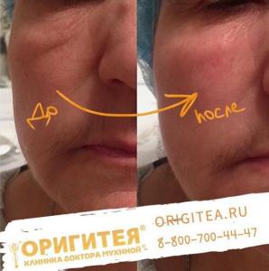 Фотография Оригитея 0